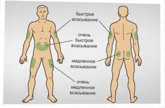 Техника инъекций и средства введения инсулина